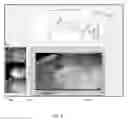 Fig. 09 - System and method for enhanced data analysis with video enabled software tools for medical environments