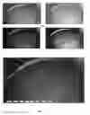 Fig. 10 - System and method for enhanced data analysis with video enabled software tools for medical environments