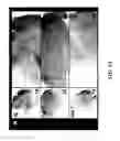 Fig. 09 - COMPOSITIONS AND METHODS FOR TREATING AND DIAGNOSING OCULAR DISORDERS