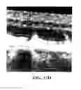 Fig. 33 - COMPOSITIONS AND METHODS FOR TREATING AND DIAGNOSING OCULAR DISORDERS