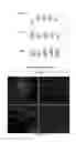Fig. 49 - COMPOSITIONS AND METHODS FOR TREATING AND DIAGNOSING OCULAR DISORDERS
