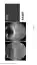Fig. 69 - COMPOSITIONS AND METHODS FOR TREATING AND DIAGNOSING OCULAR DISORDERS