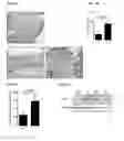 Fig. 05 - IL-34 ANTISENSE OLIGONUCLEOTIDES AND METHODS OF USING SAME