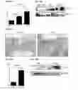 Fig. 13 - IL-34 ANTISENSE OLIGONUCLEOTIDES AND METHODS OF USING SAME