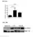 Fig. 14 - IL-34 ANTISENSE OLIGONUCLEOTIDES AND METHODS OF USING SAME