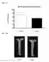 Fig. 02 - METHODS FOR TREATMENT OF ATHEROSCLEROSIS