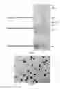 Fig. 04 - Methods of treatment utilizing biocompatible nanoparticles and therapeutic agents