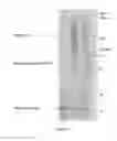 Fig. 07 - Methods of treatment utilizing biocompatible nanoparticles and therapeutic agents