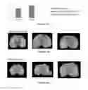 Fig. 14 - Biodegradable polymeric nanoparticle conjugates and use thereof