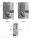 Fig. 03 - Sterilization tray fastener and related methods
