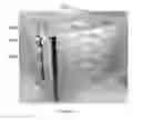 Fig. 05 - Sterilization tray fastener and related methods