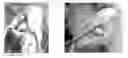 Fig. 01 - Solid forms for tissue repair