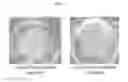 Fig. 03 - INJECTABLE SILK FIBROIN PARTICLES AND USES THEREOF