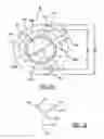 Fig. 14 - Intravascular ventricular assist device