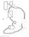 Fig. 02 - METHODS OF ADMINISTERING NITRIC OXIDE TO ARTERIAL OR ARTERIALIZED BLOOD