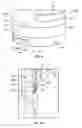Fig. 07 - Injection system for injecting fluid into a patient having an injector head and a side cover