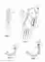 Fig. 09 - Suction catheter systems for applying effective aspiration in remote vessels, especially cerebral arteries