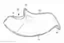 Fig. 01 - Catheter placement assist device and method of use