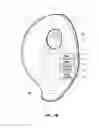 Fig. 03 - Catheter placement assist device and method of use