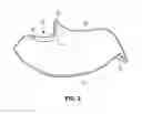 Fig. 04 - Catheter placement assist device and method of use