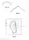 Fig. 06 - Catheter placement assist device and method of use