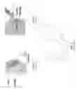 Fig. 02 - Method and apparatus for treating fluid build-up in a body cavity, including method and apparatus for treating ascites and pleural effusions