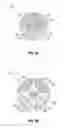 Fig. 05 - Dilation system and method