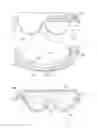 Fig. 07 - Electrode system, device and method for the treatment of eye diseases, in particular dry eye