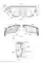 Fig. 09 - Electrode system, device and method for the treatment of eye diseases, in particular dry eye