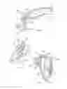 Fig. 10 - Electrode system, device and method for the treatment of eye diseases, in particular dry eye