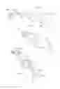 Fig. 12 - Electrode system, device and method for the treatment of eye diseases, in particular dry eye