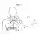 Fig. 02 - Apparatus and methods for assisted breathing by transvascular nerve stimulation