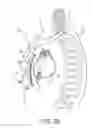 Fig. 05 - Tachyarrhythmia induction by an extra-cardiovascular implantable cardioverter defibrillator