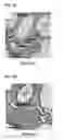 Fig. 02 - Dendrite-reinforced titanium-based metal matrix composites