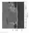 Fig. 23 - Method and functional architecture for inline repair of defective imaging arrays