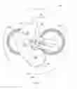 Fig. 06 - Adjustable stroke mechanism for random orbital machine