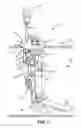 Fig. 02 - Fuel pump assembly with removable and/or movable supports