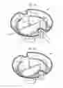 Fig. 02 - METHOD AND APPARATUS FOR FOOD AND DRINK RECEPTACLE
