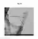 Fig. 10 - Heat transfer medium containing multi-wall carbon nanotubes