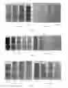Fig. 06 - L-type amylase variant and use thereof