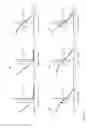 Fig. 10 - RECOMBINANT SERINE PROTEASES