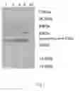Fig. 02 - Preparation method for (R)-3-hydroxyl-5-hexenoate