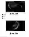 Fig. 09 - Methods and reagents for molecular proximity detection using RNA-guided nucleic acid binding proteins