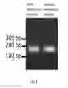 Fig. 02 - METHOD FOR IDENTIFYING A GREATER RISK FOR DEVELOPING BRONCHOPULMONARY DYSPLASIA AND PRIMER PAIR FOR GENOTYPING NQO1 GENE SNP AND METHOD THEREOF