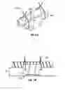 Fig. 07 - Axial reinforcement system for restorative shell