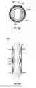 Fig. 09 - Axial reinforcement system for restorative shell