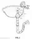 Fig. 03 - PIPE SUCTIONING ADAPTER