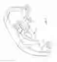 Fig. 05 - Combination forced entry resistant sash lock and tilt latch, also functioning as a window opening control device