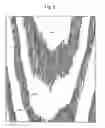Fig. 07 - Door skin, method of etching plate for forming wood grain pattern in door skin, and etched plate formed therefrom