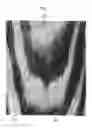 Fig. 08 - Door skin, method of etching plate for forming wood grain pattern in door skin, and etched plate formed therefrom